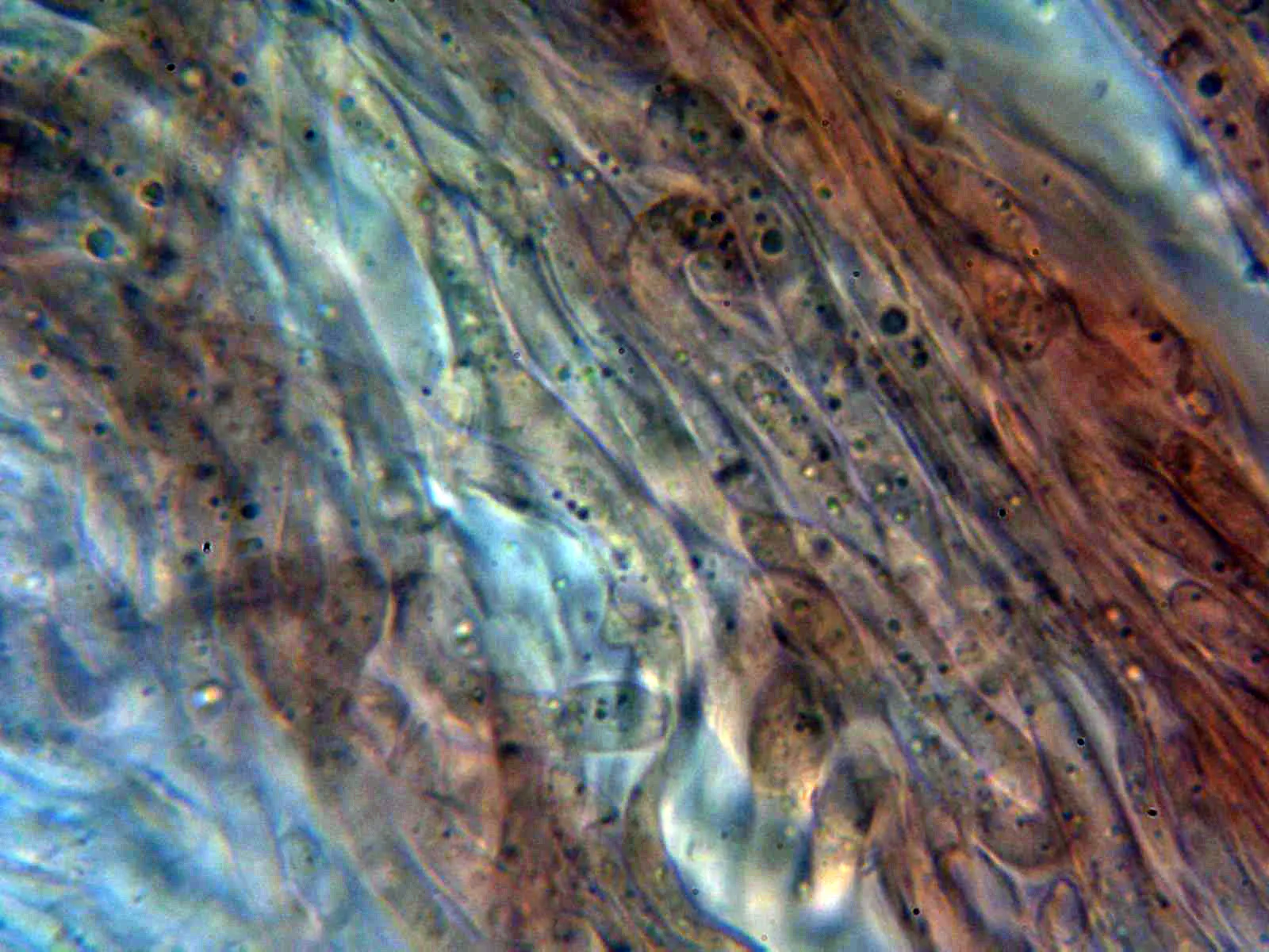 Microscopía de Polyporus squamosus - 10 - Pileipellis